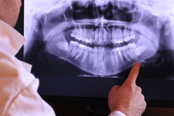Best Emergency Treatment for Toothache in Winter Beach, FL