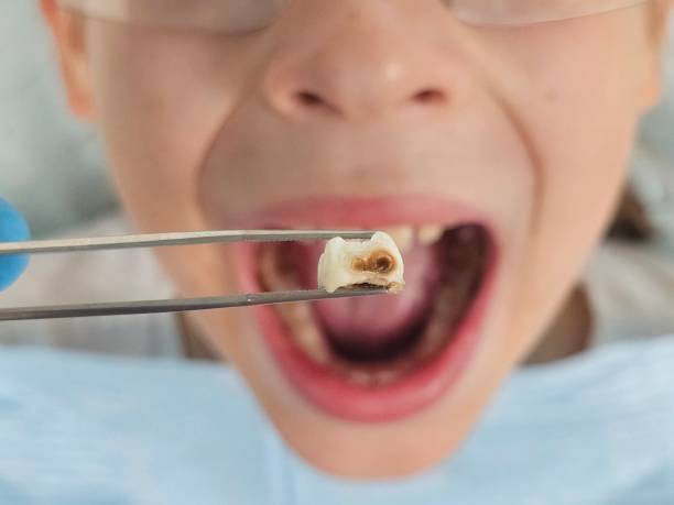 Best Urgent Dental Care in Winter Beach, FL