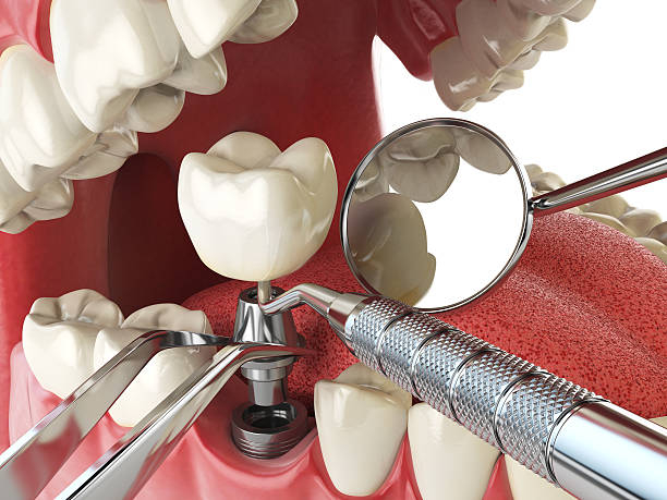 Best Emergency Dental Care for Trauma or Injury in Winter Beach, FL